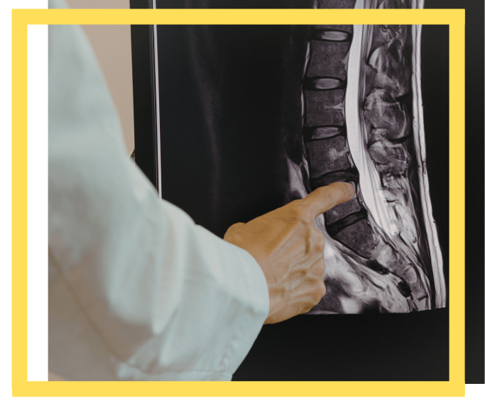 spinal cord injury lawyer houston tx