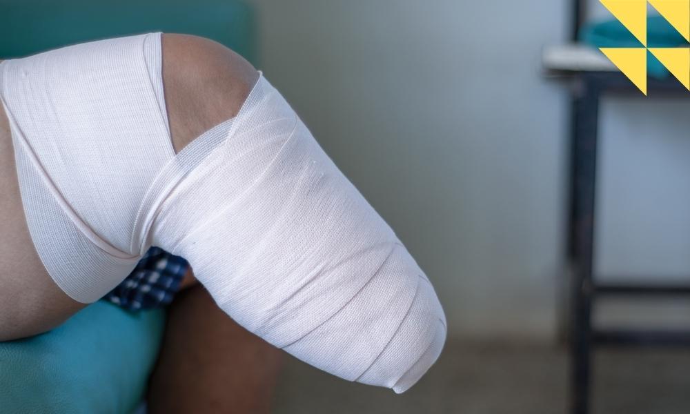 Houston Amputation Injury Lawyer