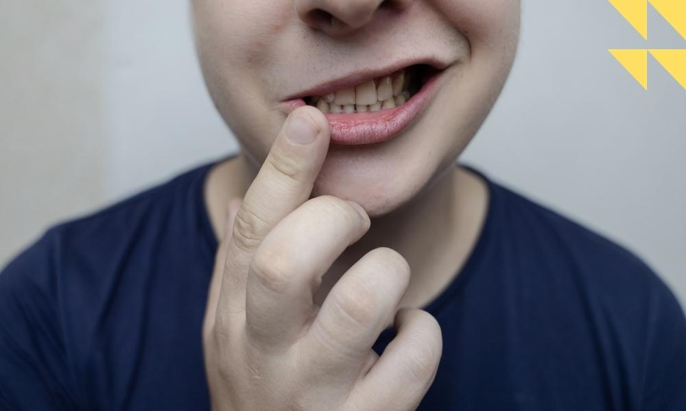 Houston Facial Paralysis Attorney