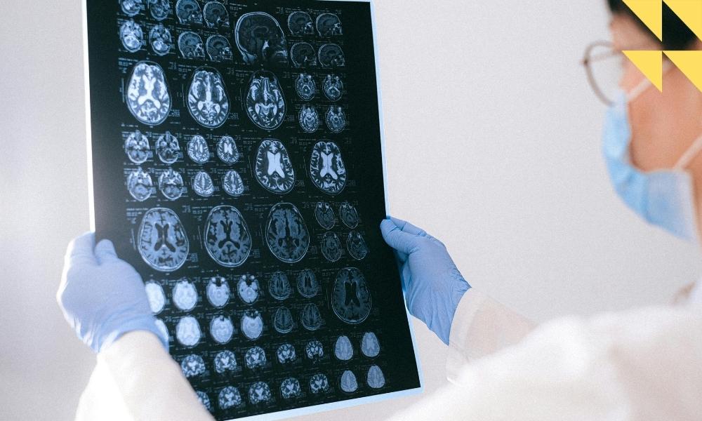 Houston Kernicterus Hyperbilirubinemia Injury Lawyer