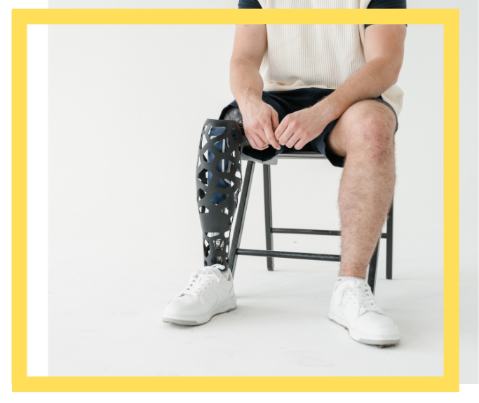 amputation accident lawyer houston tx