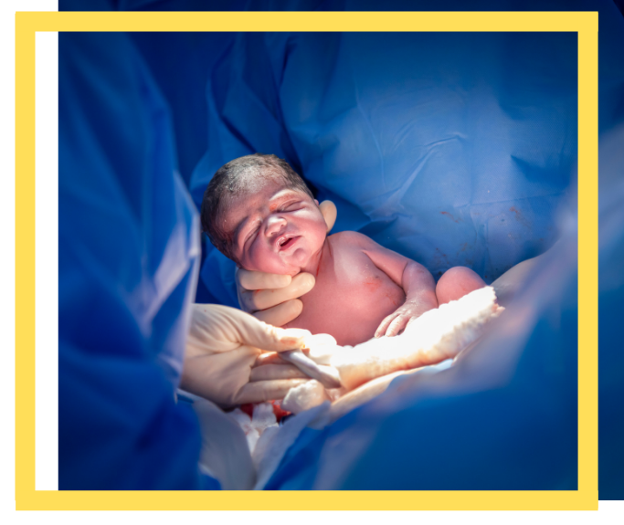 shoulder dystocia attorney houston