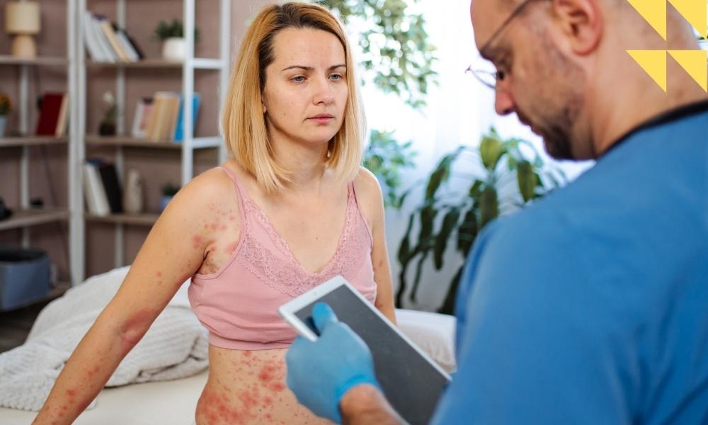 Houston SJS Malpractice Lawyer