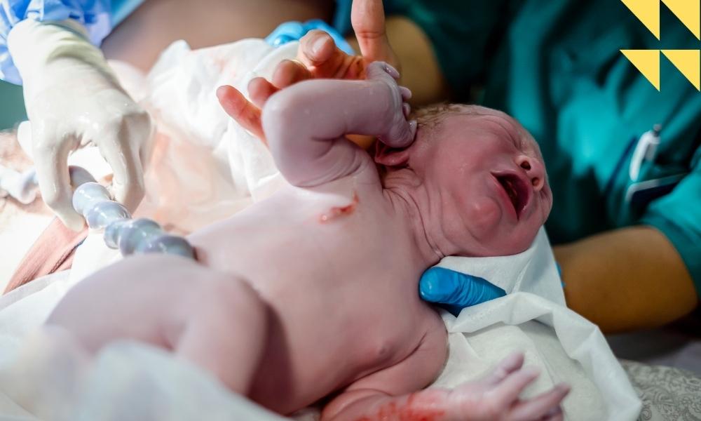 Houston Umbilical Cord Prolapse Lawyer