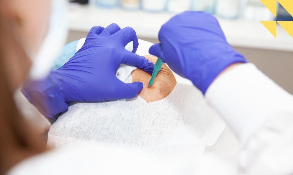 Stevens-Johnson Syndrome Attorney