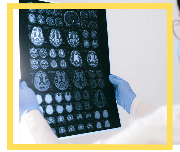 Wernicke-Korsakoff Syndrome Lawyer in Houston, TX