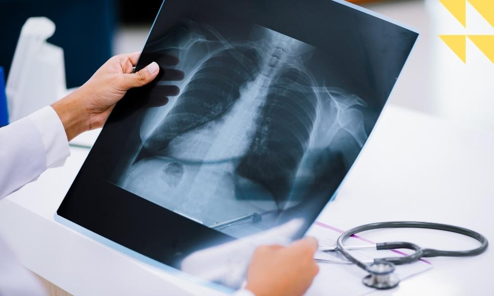 Birth Spinal Cord Injury Lawyer