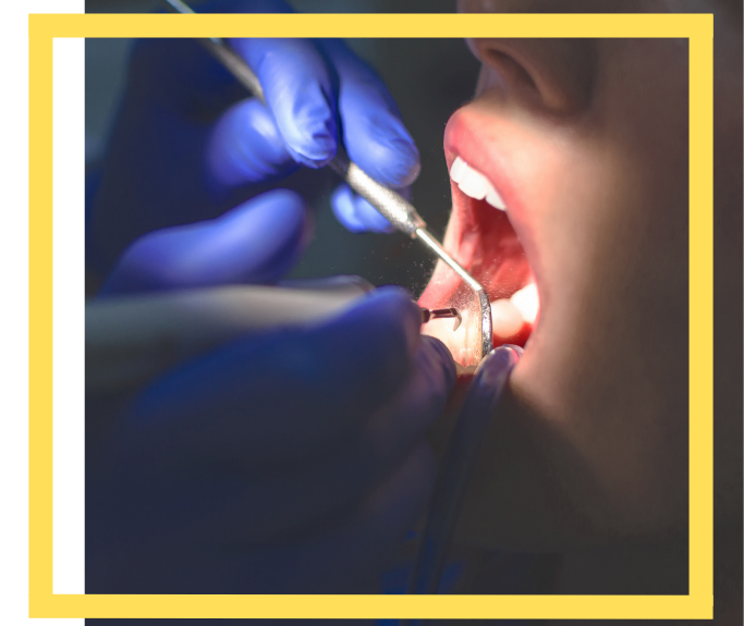 Dental Malpractice Lawyer Houston, TX