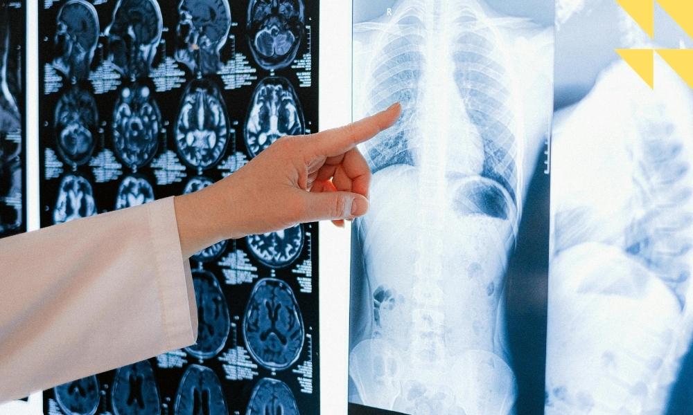 Houston Radiologist Malpractice Attorney