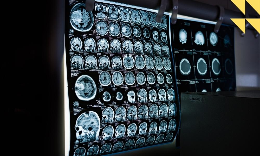 Houston Radiology Malpractice Attorneys