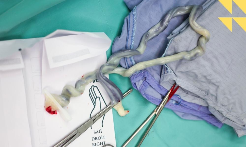 Umbilical Cord Compression Lawyer in Houston, TX