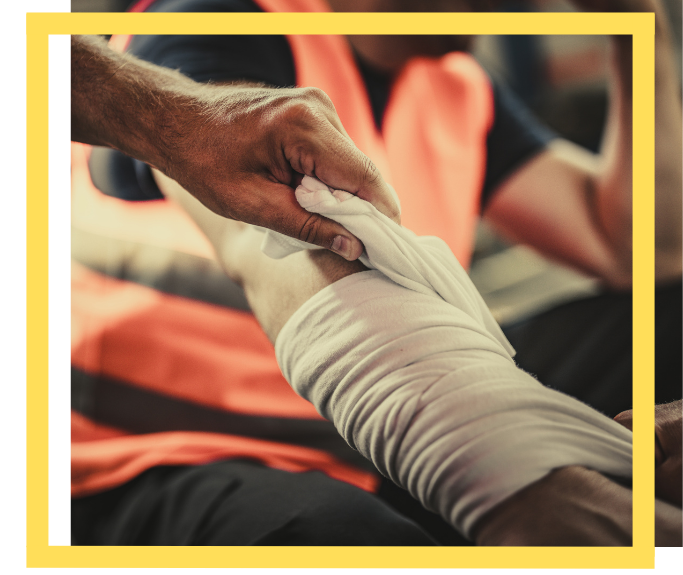 Houston Burn Injury Lawyer