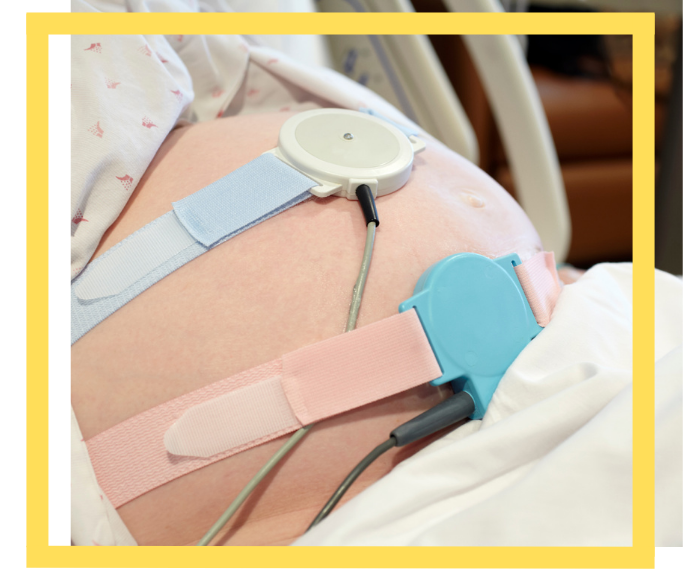 Houston Fetal Distress Attorney