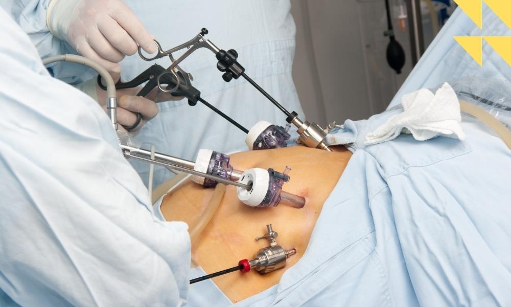Houston, TX Bariatric Surgery Malpractice Lawyer
