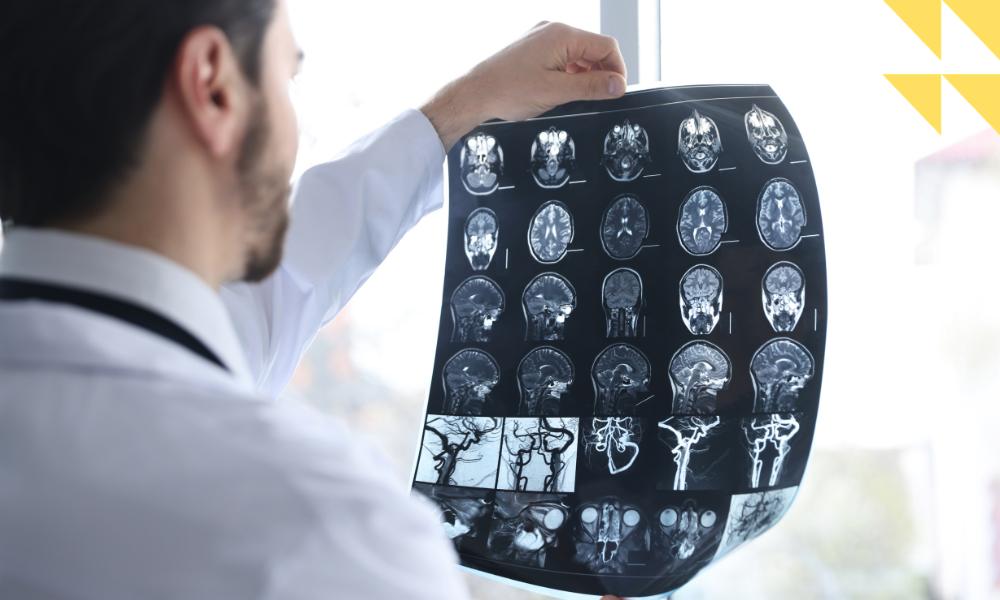 Intracranial Hemorrhage Injury Lawyer Houston, TX